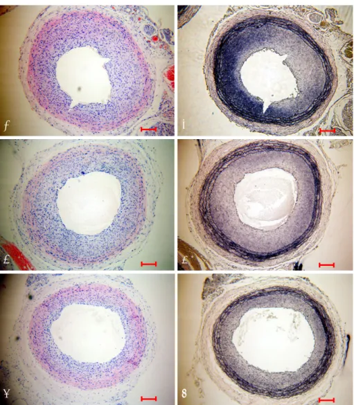 Fig. 1.  Representative carotid arteries from the control (A and B), dRK6 (C and D) and anti-flt-1 groups (E and F) 14 days after balloon injury  illustrating hematoxylin and eosin staining (A, C and E) and elastic fiber staining (B, D and F)