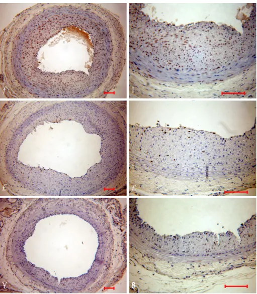 Fig. 2.  Neointimal area on day 14 after balloon injury. Neointimal areas were reduced in the dRK6 (n=5) and anti-flt-1 groups (n=5)  vs
