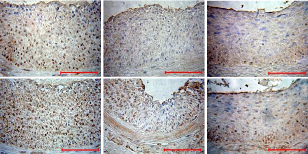 Fig. 5.  Carotid artery sections from the control, dRK6 and anti-flt1 groups 14 days post-injury stained with MCP-1 and IL-6