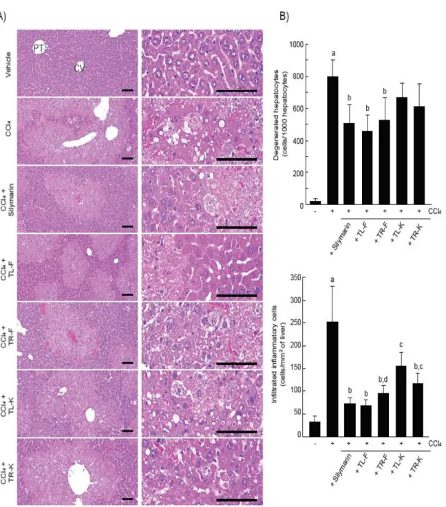Figure  3. Histopathological  analysis.  (A)  The  liver  tissues  were  stained  with  hematoxylin-eosin