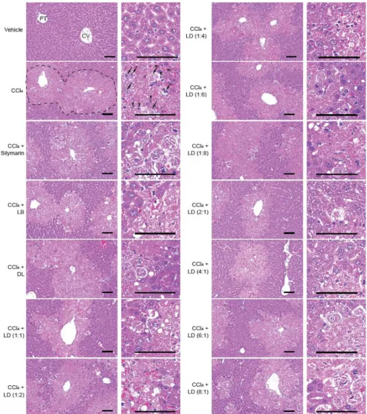 Figure  3. Histopathological  analysis.  The  liver  tissues  were  stained  with  hematoxylin  and  eosin,  and  observed  under  a  microscope  ×100  (left)  or  ×400  (right)  magnification