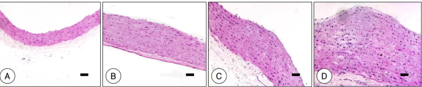 Fig. 2.  H-E staining of rat ascending aorta at experiment 40 weeks. A: LT-N; no intima proliferation
