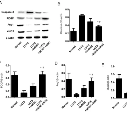 Figure 4. (A) All groups were compared  for Caspase-3, PDGF, Ang 1, and eNOS  in  pelvic  nerve  by  western  blot