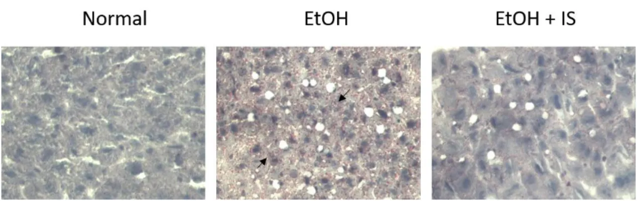 Fig.  3. Liver  sections  stained  with  Oil  Red  O  staining.