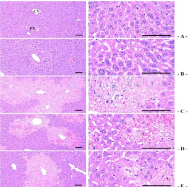 Fig.  5.  Representative  general  histopathogical  profiles  of  the  hepatic  tissues,  taken  from  intact  or  acute  CCl 4 -treated  mouse  with/without  seBYTE  administration