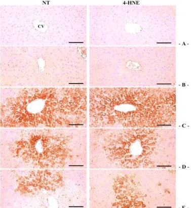 Fig.  6.  Representative  NT  and  4-HNE  immunoreactivities  of  the  hepatic  tissues,  taken  from  intact  or  acute  CCl 4 -treated  mouse  with/without  seBYTE  administration