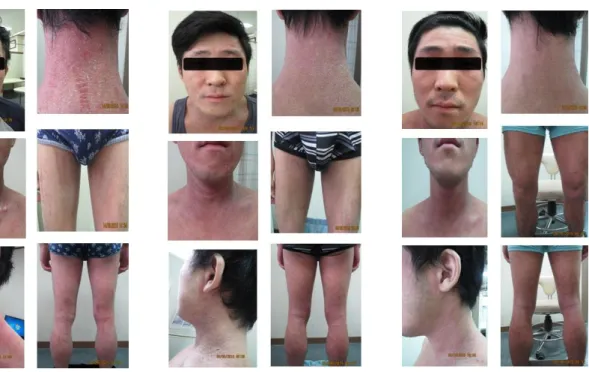 Fig  1.  2015.09.14.             Fig  2.  2015.09.30.             Fig  3.  2015.10.26