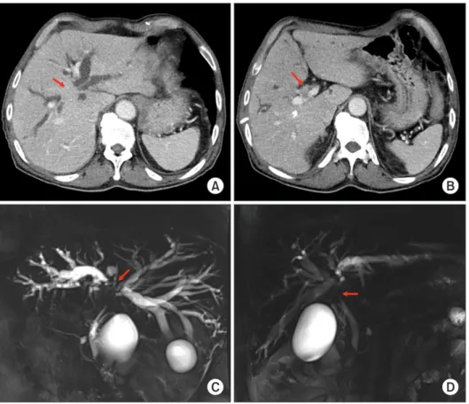 Fig. 1. Preoperative imaging study findings. 