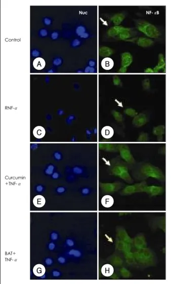 Fig. 2.  Immunocytochemical analysis of NF-κB p65 localization.