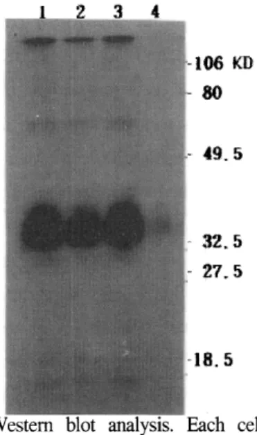 Fig.  2.  Northern  blot  analysis.  The  10tLg  of  total  RNA  isolated  from  wild  HeLa2  cell(lane  1 ),  cloned  HeLa2  cell (lane  2)  and  KB  cell(lane  3)  were  hybridized  as  described  in  Materials  and  Methods