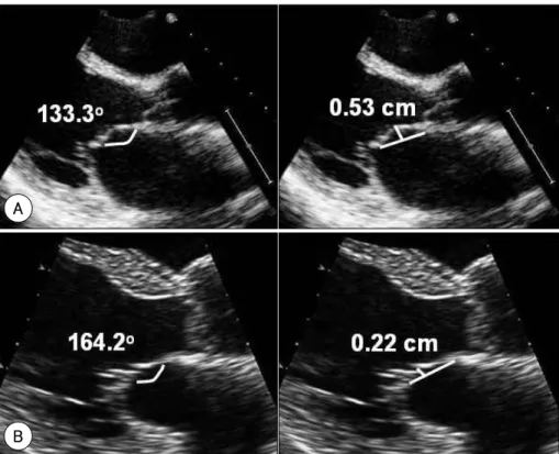 Table 1 . The baseline demographics and clinical characteristics in patients with ischemic mitral regurgitation 
