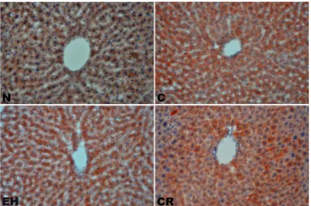 Fig.  10.  The  effect  of  EH  and  CR  on  lipid  droplets  of  hepatic  lobule  in  HFD  fed  mice  for  5  weeks(Oil  Red  O  stain,  ×200).