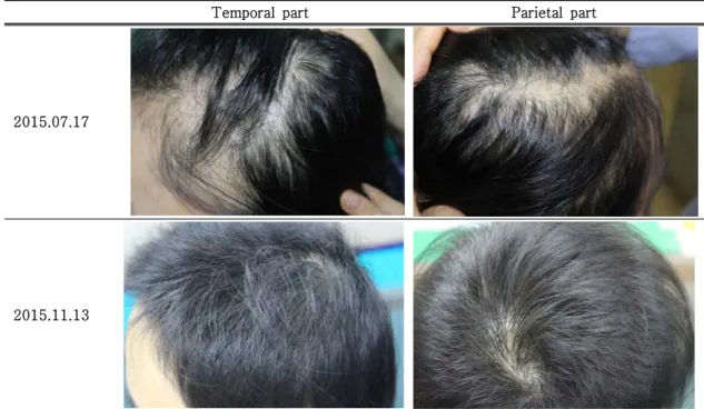 Fig.  1.  Progress  of  Case