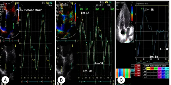 Fig. 5.  Strain analysis of chronic AF. Peak systolic strain (A) and the strain rate (B) by the tissue-Doppler based strain and the 2-dimensional strain (C), respectively, in the chronic AF patients