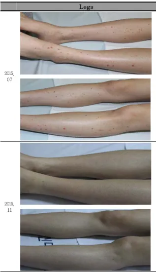 Fig. 2. Progress of Case (Case 2)