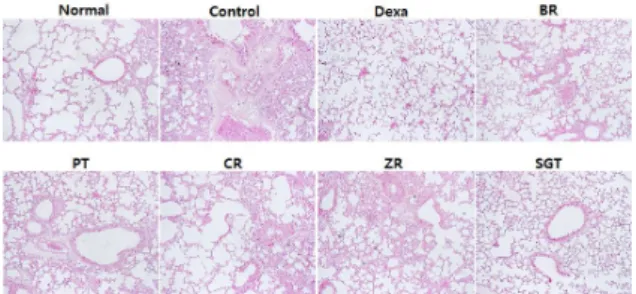 Fig.  16.  Effect  of  SGT  and  Individual  Herbs  Histophathological  Changes  of  Lung  Following  LPS+CSS-induced  Murine  Model  of  COPD.