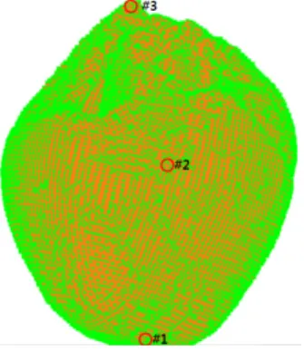 Fig. 2. The mesh of human abnormal heart used in this study.