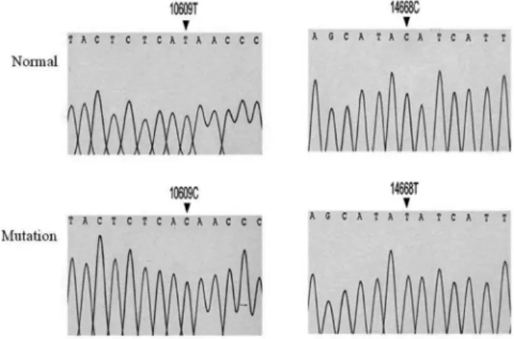 Fig.  1. Analysis of Pure-Tone Average(PTA) in normal people  and ESRD patients. 58 of normal people without ESRD and  114  of  ESRD  patients  were  analyzed  PTA