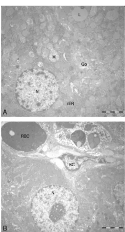 Figure 15. Electron micrograph of hepatocytes from the  9 weeks control group. 