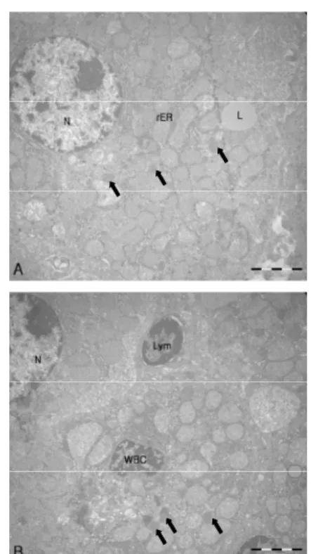 Figure 17. Electron micrograph of hepatocytes from  the CAB group. 