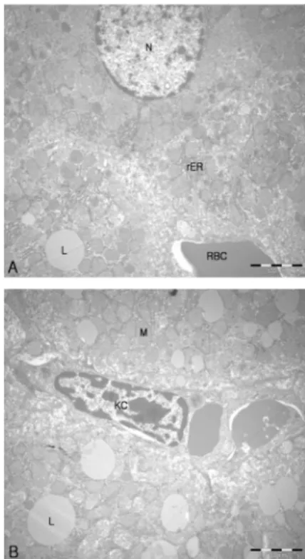Figure 14. Electron micrograph of hepatocytes from the  9 weeks normal group. 