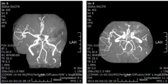 Figure 2. The Image of Brain MRA