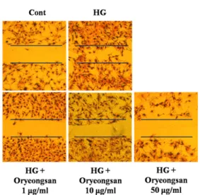 Figure 2. Effect of Oryeong-san on HG-induced RMC  migration. 