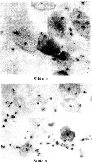 Table  2.  Concentra ti. on  of  EA  working  solu ti. on  for  papanicolaou  stain 