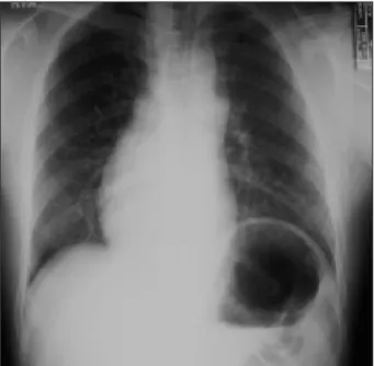 Fig. 3.  The 2D-Echocardiogram. A: parasternal short axis view;