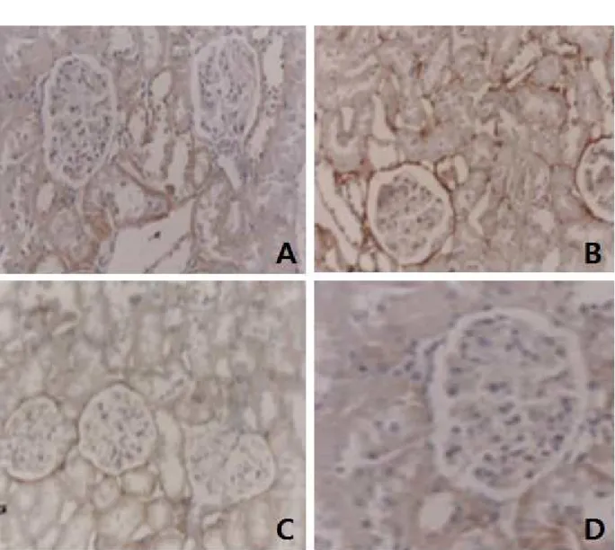 Fig. 1. TGF-β1 immunohisto-staining in rat kidney (200 ×). A: non-diabetic control group; B: DN control group; C: the group treated  with the low dose of rhein; D: the group treated with the high dose of rhein.