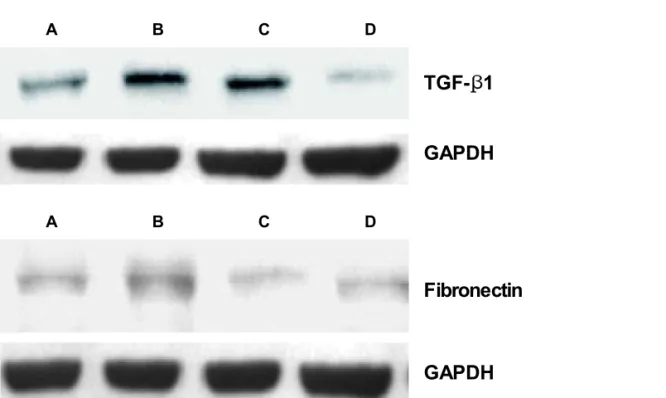 Fig. 2. TGF-β1 and fibronectin mRNA expression in renal cortex. A: Control group; B: DN Model group; C: Low concentration treated  group; D: High concentration treated group