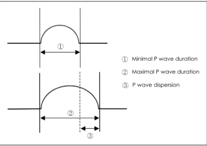 Fig. 1.  Definition of maximal P wave duration, minimal P wave du- du-ration and P wave dispersion