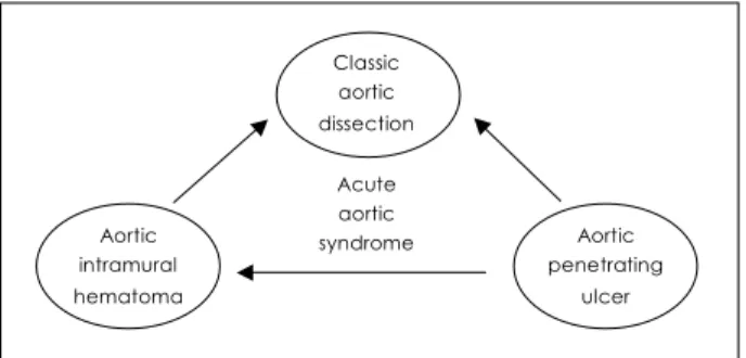 Fig. 2.  Representative images of classic dissection (A, B, C) and intramural hematoma (D, E, F)