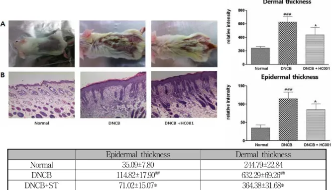 Fig. 1. Reduced hyperplasia after HC001 treatment in epidermis and dermis of DNCB-sensitized skin lessons.