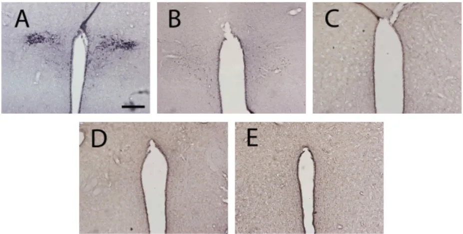 Fig. 5. Photograph of CRF-immunoreactive cells in the PVN (scale bar represent 200 um).