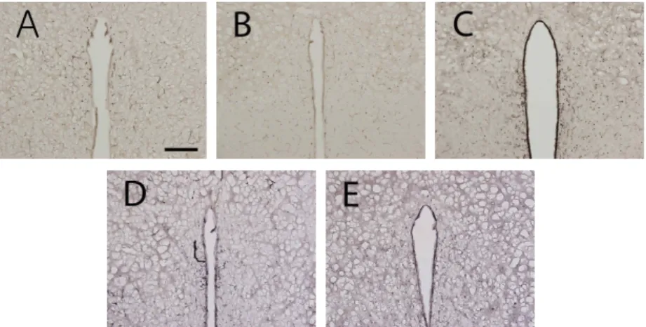 Fig. 7. Photograph of c-Fos-immunoreactive cells in the PVN(scale bar represents 200um).