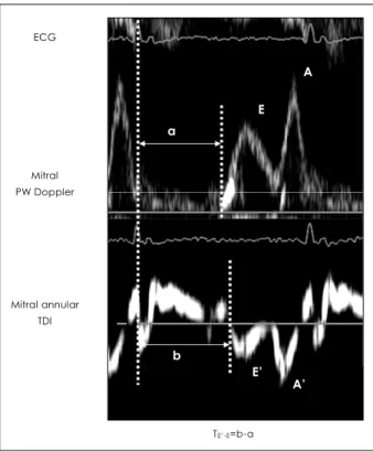 Fig. 1.  Schema for measurements of T E’ - E . T E’ - E  is defined as b-a, where a is the interval between peak of R wave and onset of mitral E velocity, and b is the interval between peak R wave and onset of E’
