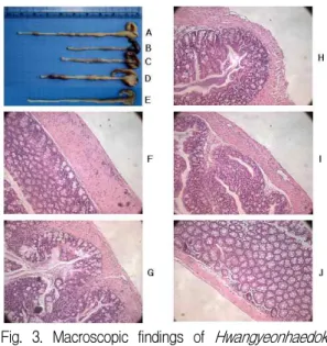 Fig. 4. Effect of Hwangyeonhaedok-tang (HHDT) on histological score and inflammatory infiltrate in DSS-induced colitis mice.