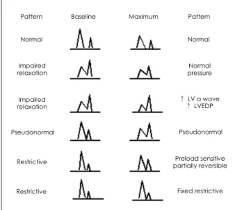 Fig. 6.  Various responses of the mitral inflow to a Valsalva maneuver.
