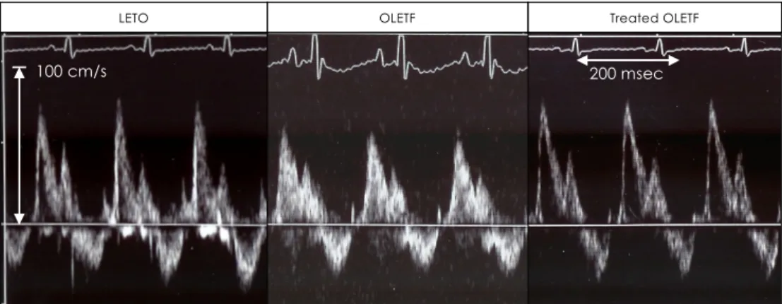 Fig. 1.  Comparison of left ventricular mitral inflow patterns at the age of 40 weeks