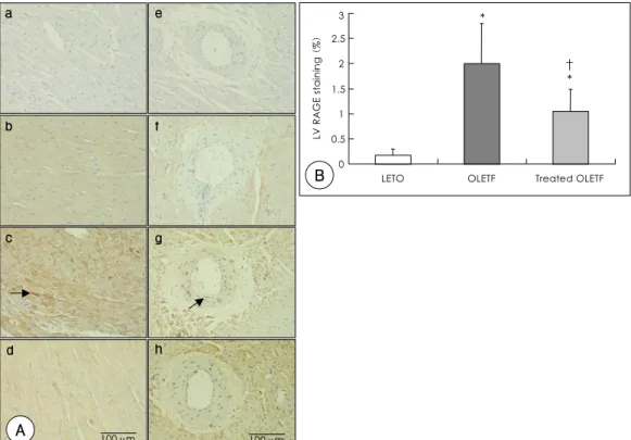 Fig. 4. A : immunohistochemical stainings for RAGE in LV sections (a through d) and perivascular structure (e through h) from the negative control (a and e), LETO (b and f), OLETF (c and g), and rosiglitazone-treated OLEFT (d and h) rats