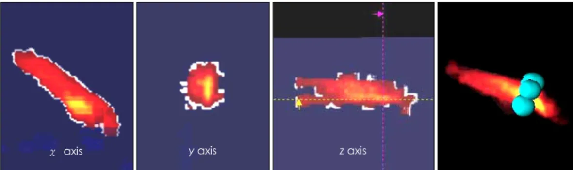 Fig. 3.  An example of reconstructed coronary artery flow using freehand 3D echocardiography with rotational scanning