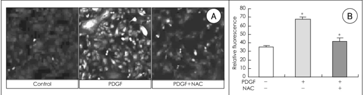 Figure 2. Effects of PDGF and NAC on the proliferation of rat aortic smooth muscle cells
