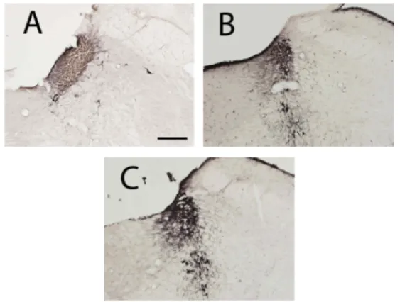 Fig. 12. Expression of TH-immunoreactive cells in LC (scale bar represents 200㎛).