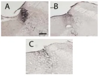 Fig.  9.  Photograph  of  the  TH-immunoreactive  cells  in  LC(scale  bar  represents  100㎛) Control  group  was  ingested  normal  saline