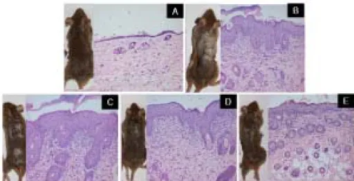 Fig.  3.  Effects  of  Sophora  flavescens  ethanol  extracts  (SFE)  on  histological  changes  of  skins  in  NC/Nga  mice.