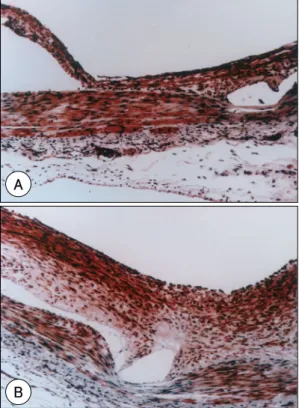 Fig. 4. The content ratio of collagen within the neoin- neoin-tima was well correlated with the pathologic area stenosis