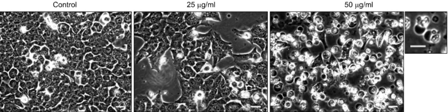 Fig. 3. Proapoptotic  activity  of  A.  rossii  extract  in  HCT116  cells.  (A)  The  sub  G0/G1  content  (%)  of  HCT116  cells  treated  with  the  extract  (0,  25,  50 μg/ml)  for  24 and 48  h  was measured  by  flow  cytometric analysis  after PI  