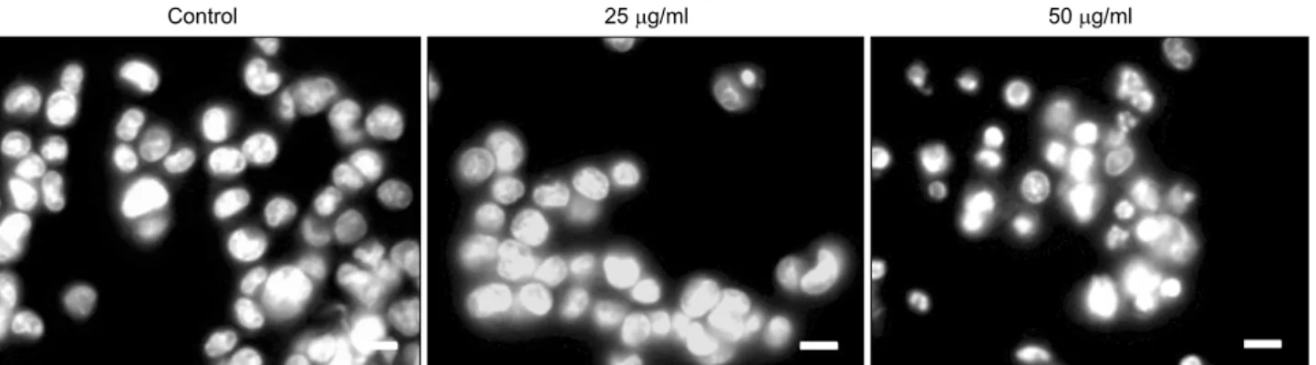 Fig. 5. Chromatin  condensation of  HCT116  cells  treated  with A.  rossii  extract. HCT116  cells were  treated  with the extract  (0,  25,  50  μg/ml)  for  48  h  and  then  stained  with  PI