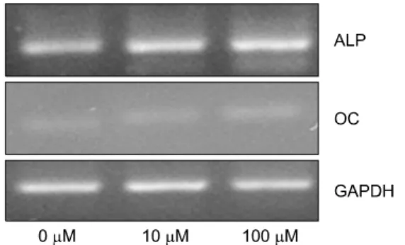 Fig. 2.  Effects  of  genistein  on  ALP  (alkaline  phosphatase)  mRNA  level,  OC  (osteocalcin)  mRNA  level  in  MG-63  cell